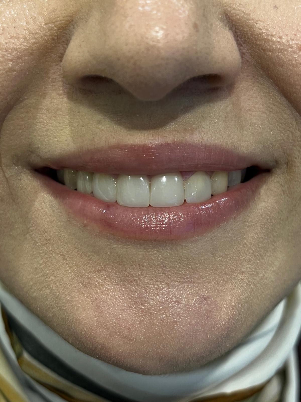 ECE Dental Patient Transformation